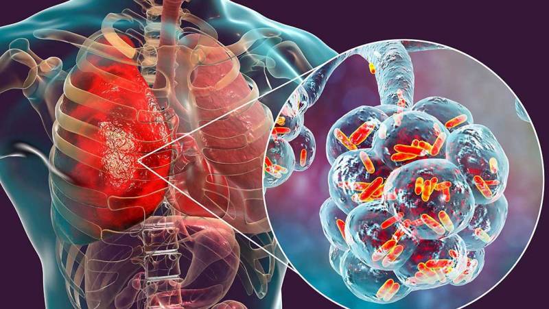 Hovuz və kondisionerlər vasitəsi ilə dəhşətli virus yayılır