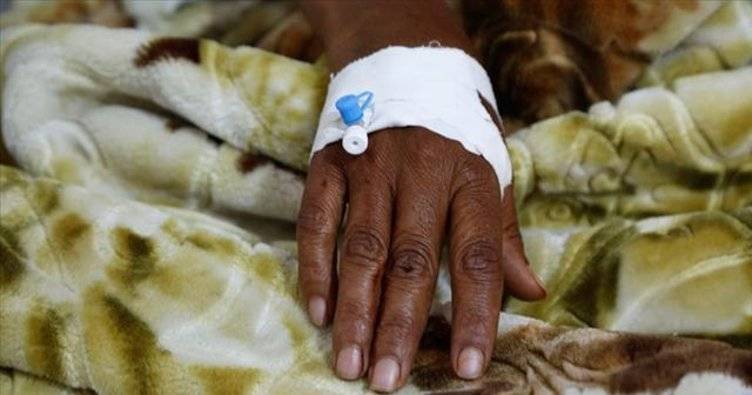 Nigeriyada meningit epidemiyasından 52 nəfər öldü