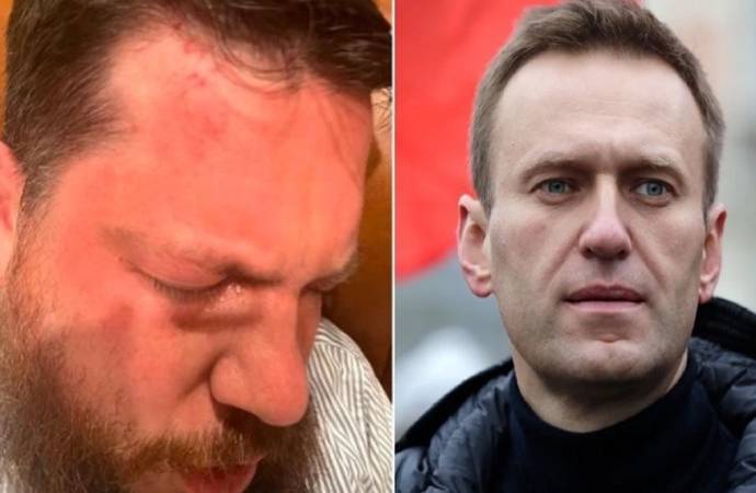 Həbsxanada ölən Navalninin köməkçisinə çəkiclə hücum edildi